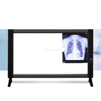X-ray Filmu Skatītājs, Apgaismojums, Gaisma, Ultra plānas Dubultā Xray Skatītāju Gaismas Panelis Ekrāna Iekārtas, 110-240V 24W 76x50.6cm